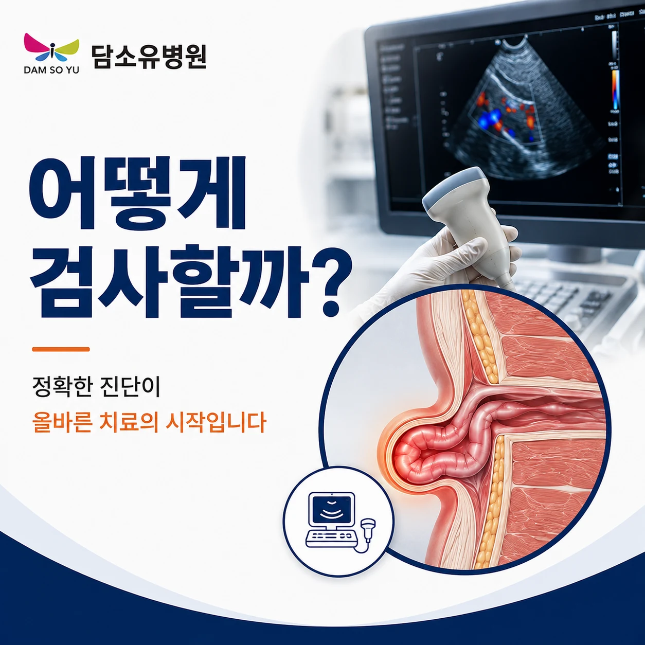 탈장 검사는 튀어나온 부분만 확인하는 걸까요?