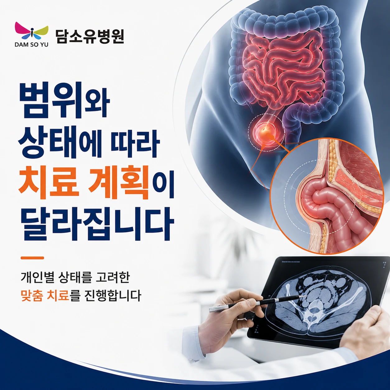 결국 탈장은 무엇을 보고 치료 여부를 판단할까요?